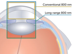 Long-range OCT imaging of the eye at 800 nm
