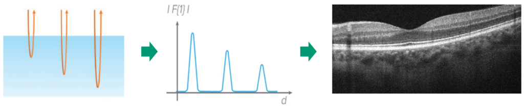 Schematic of light scattering, OCT A-scan analysis, and a B-scan image