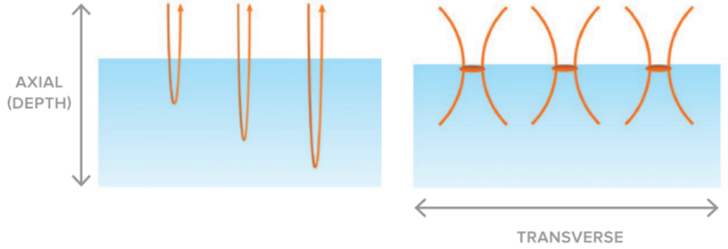 Schematic of axial resolution vs transverse resolution in near infrared optical coherence tomography