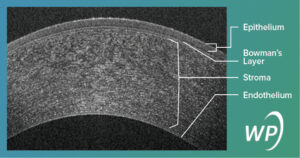 OCT Cornea image labeled