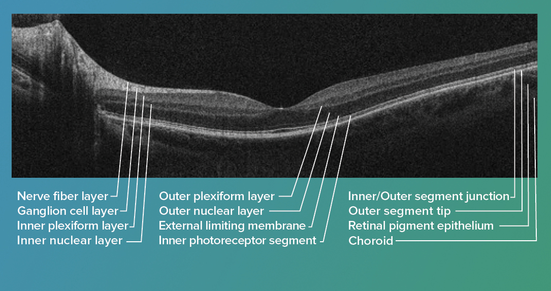 oct retinal layers diagram