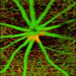 MicroAngio retina image