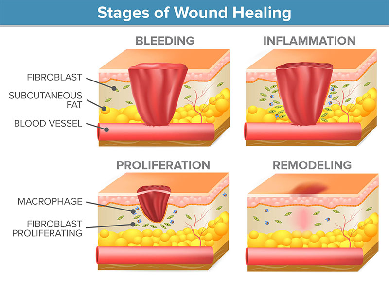 Phases Of Wound Healing Diagram Surgical Wound Healing Stage